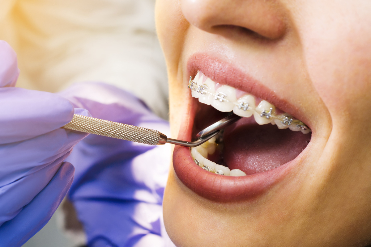 Dental Care