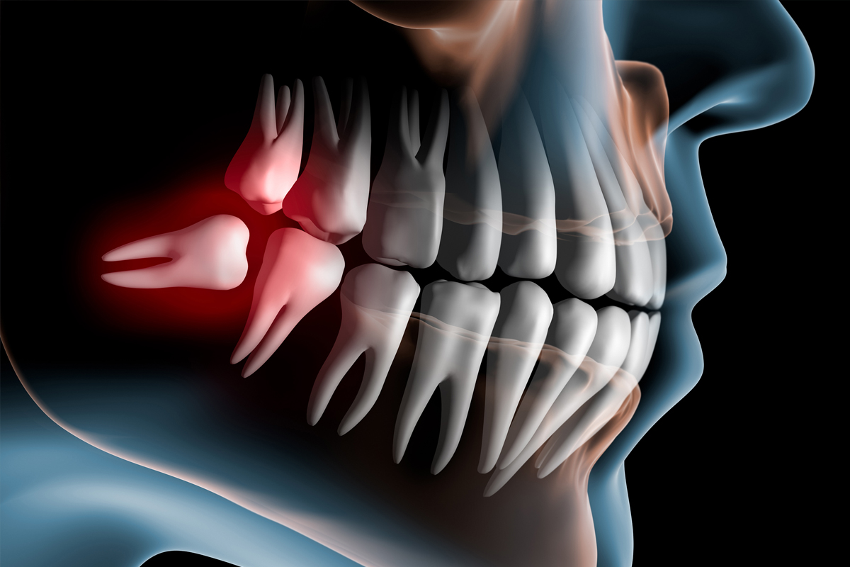 Dental Care